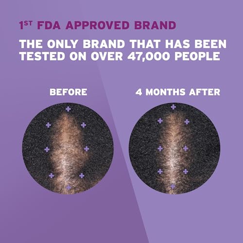 Rogaine 5% Minoxidil Foam - Women's 2-Month Hair Regrowth Treatment - Image 3