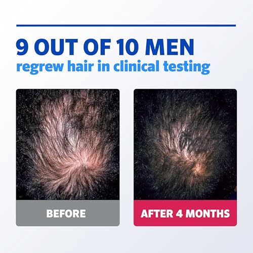 Men's Rogaine 5% Minoxidil Foam for Hair Regrowth, 3-Month Supply - Image 4