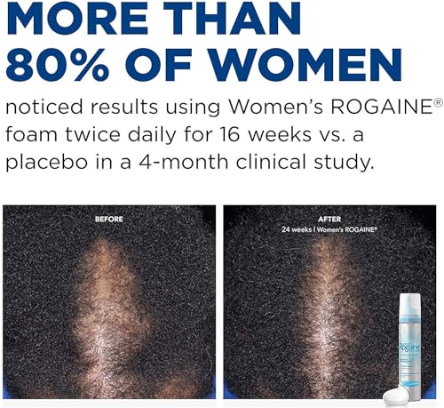 Rogaine 5% Minoxidil Foam - Women's 2-Month Hair Regrowth Treatment - Image 4