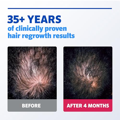 Men's Rogaine 5% Minoxidil Extra Strength Hair Regrowth Solution, 3-Month Supply - Image 4